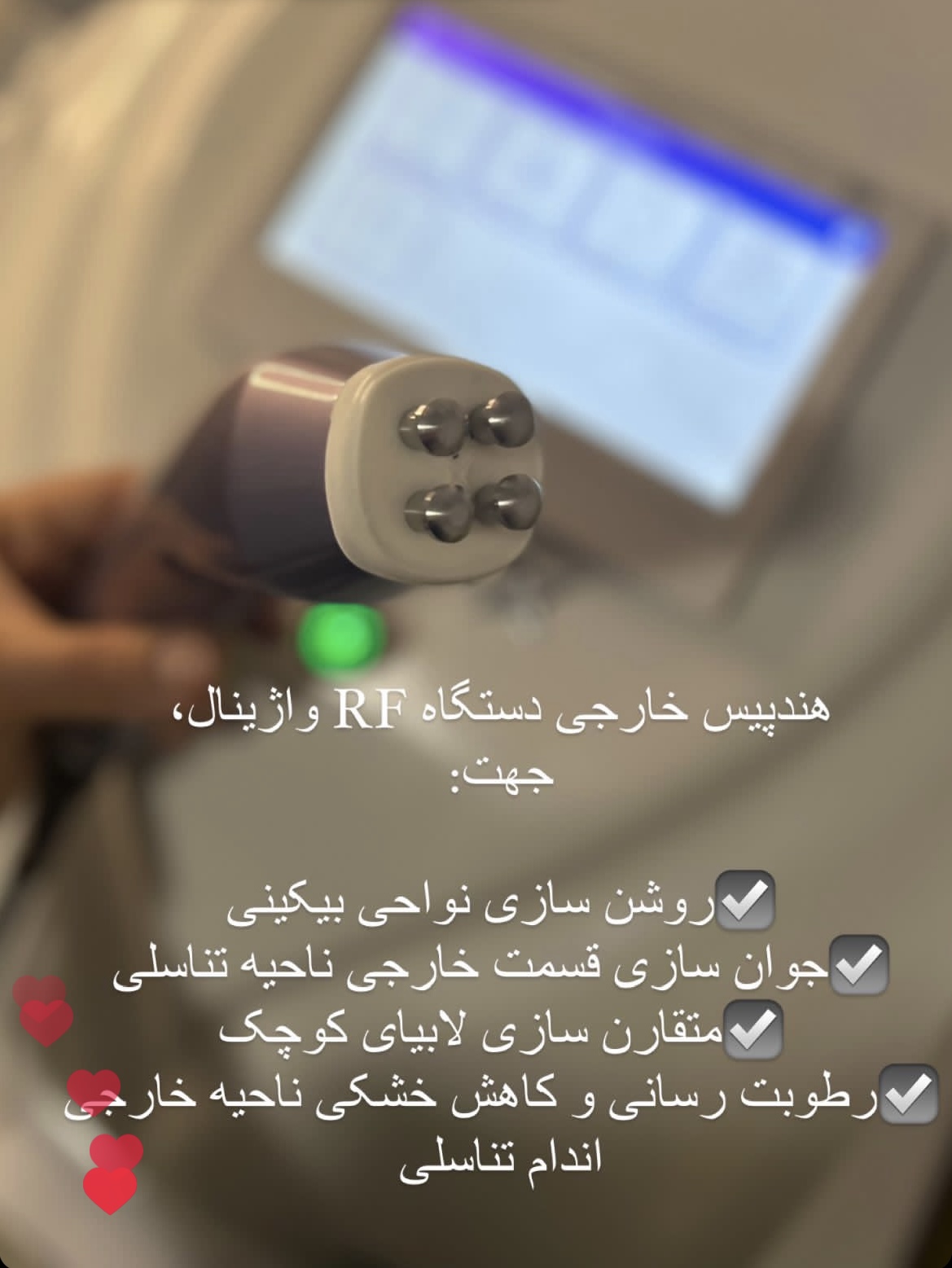 فروش دستگاه آر اف واژینال